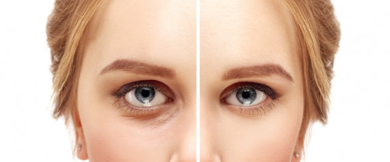 Benefits of Eyelid Lift Surgery